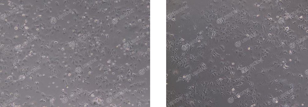Hep 3B cells in abnormal status